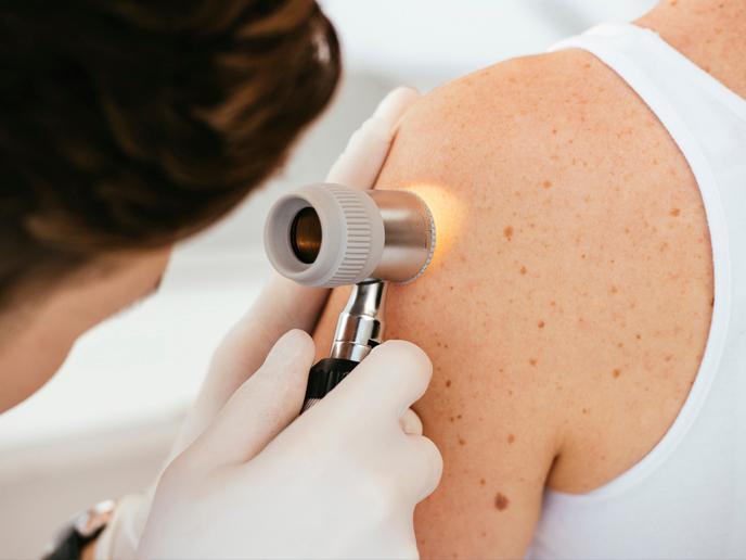 Melanoma insights could hold benefit for all cancers